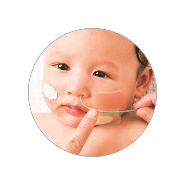 Fisher & Paykel WigglewiNG™ for Junior 2 and 2+ for Optiflow Nasal Cannulas 10pk-Respiratory Care-Fisher & Paykel-XS & S-capitalmedicalsupply.ca